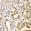 Immunohistochemistry of paraffin-embedded Human gastric using RAC1 Polyclonal Antibody at dilution of  1:100 (40x lens).