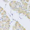Immunohistochemistry of paraffin-embedded Human stomach using CLIP1 Polyclonal Antibody at dilution of  1:100 (40x lens).