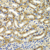Immunohistochemistry of paraffin-embedded Mouse kidney using DGKE Polyclonal Antibody at dilution of  1:100 (40x lens).