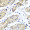 Immunohistochemistry of paraffin-embedded Human stomach using PSTPIP1 Polyclonal Antibody at dilution of  1:100 (40x lens).