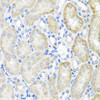 Immunohistochemistry of paraffin-embedded Mouse kidney using PSTPIP1 Polyclonal Antibody at dilution of  1:100 (40x lens).
