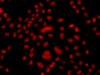 Immunofluorescence analysis of A549 cells using FBXW11 Polyclonal Antibody