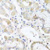 Immunohistochemistry of paraffin-embedded Human stomach using RPL36 Polyclonal Antibody at dilution of  1:100 (40x lens).