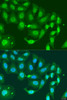 Immunofluorescence analysis of U2OS cells using MLH3 Polyclonal Antibody at dilution of  1:100. Blue: DAPI for nuclear staining.