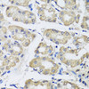 Immunohistochemistry of paraffin-embedded Human stomach using SCG3 Polyclonal Antibody at dilution of  1:100 (40x lens).