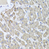 Immunohistochemistry of paraffin-embedded Human liver damage using ALKBH4 Polyclonal Antibody at dilution of  1:100 (40x lens).