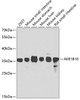 Western blot analysis of extracts of various cell lines using AKR1B10 Polyclonal Antibody at dilution of 1:1000.