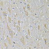 Immunohistochemistry of paraffin-embedded Mouse brain using RAB17 Polyclonal Antibody at dilution of  1:100 (40x lens).