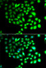 Immunofluorescence analysis of A549 cells using TCEAL8 Polyclonal Antibody