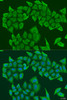 Immunofluorescence analysis of U2OS cells using HAUS8 Polyclonal Antibody at dilution of  1:100. Blue: DAPI for nuclear staining.