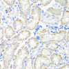 Immunohistochemistry of paraffin-embedded Mouse kidney using SPICE1 Polyclonal Antibody at dilution of  1:100 (40x lens).