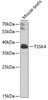 Western blot analysis of extracts of Mouse testis using TSSK4 Polyclonal Antibody at dilution of 1:1000.