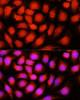 Immunofluorescence analysis of HeLa cells using ACADVL Polyclonal Antibody at dilution of  1:100 (40x lens). Blue: DAPI for nuclear staining.