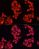 Immunofluorescence analysis of HeLa cells using ALDH9A1 Polyclonal Antibody at dilution of  1:100. Blue: DAPI for nuclear staining.