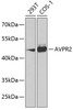 Western blot analysis of extracts of various cell lines using AVPR2 Polyclonal Antibody at dilution of 1:1000.