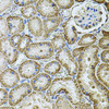 Immunohistochemistry of paraffin-embedded Rat kidney using CDH16 Polyclonal Antibody at dilution of  1:100 (40x lens).