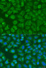 Immunofluorescence analysis of U2OS cells using EIF2B1 Polyclonal Antibody at dilution of  1:100. Blue: DAPI for nuclear staining.