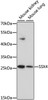 Western blot analysis of extracts of various cell lines using SSX4 Polyclonal Antibody at dilution of 1:1000.