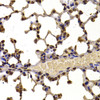 Immunohistochemistry of paraffin-embedded Mouse lung using WHSC1 Polyclonal Antibody at dilution of  1:100 (40x lens).