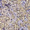 Immunohistochemistry of paraffin-embedded Mouse kidney using WHSC1 Polyclonal Antibody at dilution of  1:100 (40x lens).