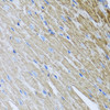 Immunohistochemistry of paraffin-embedded Mouse heart using MTX2 Polyclonal Antibody at dilution of  1:100 (40x lens).