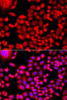 Immunofluorescence analysis of A549 cells using MTHFD1L Polyclonal Antibody