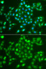 Immunofluorescence analysis of A549 cells using UCHL5 Polyclonal Antibody