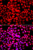 Immunofluorescence analysis of A549 cells using TDP1 Polyclonal Antibody
