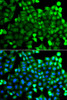 Immunofluorescence analysis of A549 cells using NCALD Polyclonal Antibody