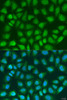 Immunofluorescence analysis of U2OS cells using SOCS4 Polyclonal Antibody at dilution of  1:100. Blue: DAPI for nuclear staining.