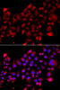Immunofluorescence analysis of A549 cells using RRM2B Polyclonal Antibody
