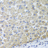 Immunohistochemistry of paraffin-embedded Human liver damage using OSGEPL1 Polyclonal Antibody at dilution of  1:100 (40x lens).