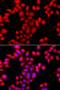 Immunofluorescence analysis of A549 cells using OSGEPL1 Polyclonal Antibody