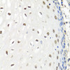 Immunohistochemistry of paraffin-embedded Human esophagus using CNOT8 Polyclonal Antibody at dilution of  1:100 (40x lens).