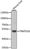 Western blot analysis of extracts of Mouse liver using TRMT61B Polyclonal Antibody at dilution of 1:1000.