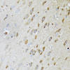 Immunohistochemistry of paraffin-embedded Rat brain using MT-ND5 Polyclonal Antibody at dilution of  1:100 (40x lens).