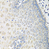 Immunohistochemistry of paraffin-embedded Human esophagus using OXCT1 Polyclonal Antibody at dilution of  1:100 (40x lens).