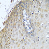 Immunohistochemistry of paraffin-embedded Human esophagus using POR Polyclonal Antibody at dilution of  1:100 (40x lens).