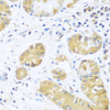 Immunohistochemistry of paraffin-embedded Human stomach using UCHL3 Polyclonal Antibody at dilution of  1:100 (40x lens).