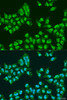 Immunofluorescence analysis of U2OS cells using THOC1 Polyclonal Antibody at dilution of  1:100. Blue: DAPI for nuclear staining.