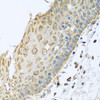 Immunohistochemistry of paraffin-embedded Human esophagus using ARFGAP3 Polyclonal Antibody at dilution of  1:100 (40x lens).