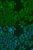 Immunofluorescence analysis of U2OS cells using NLRP2 Polyclonal Antibody at dilution of  1:100. Blue: DAPI for nuclear staining.
