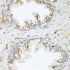 Immunohistochemistry of paraffin-embedded Human prostate using HPSE2 Polyclonal Antibody at dilution of  1:100 (40x lens).