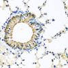 Immunohistochemistry of paraffin-embedded Mouse lung using KCTD15 Polyclonal Antibody at dilution of  1:100 (40x lens).