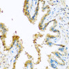Immunohistochemistry of paraffin-embedded Rat lung using KCTD15 Polyclonal Antibody at dilution of  1:100 (40x lens).