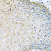 Immunohistochemistry of paraffin-embedded Human esophagus using KCTD15 Polyclonal Antibody at dilution of  1:100 (40x lens).