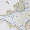 Immunohistochemistry of paraffin-embedded Human prostate using LLGL2 Polyclonal Antibody at dilution of  1:200 (40x lens).