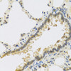 Immunohistochemistry of paraffin-embedded Rat lung using RSPO1 Polyclonal Antibody at dilution of  1:100 (40x lens).