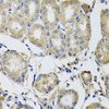 Immunohistochemistry of paraffin-embedded Human stomach using MRPS22 Polyclonal Antibody at dilution of  1:100 (40x lens).