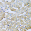 Immunohistochemistry of paraffin-embedded Human liver damage using AP1M2 Polyclonal Antibody at dilution of  1:100 (40x lens).